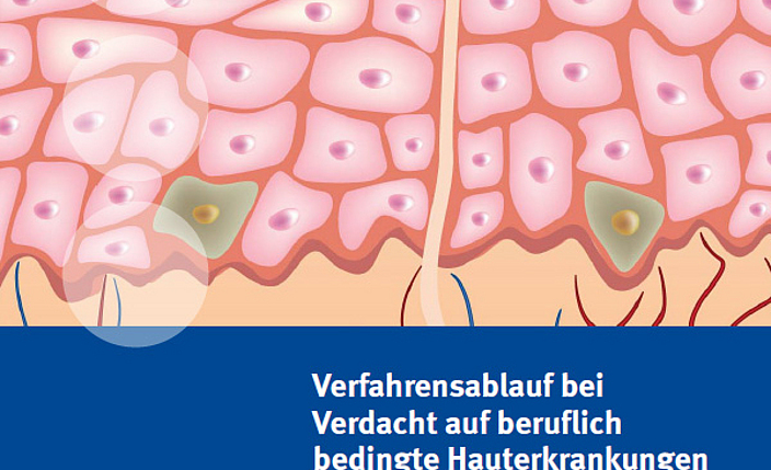 Titelbild der DGUV Information 250-005: Verfahrensablauf bei Verdacht auf beruflich bedingte Hauterkrankungen.
    